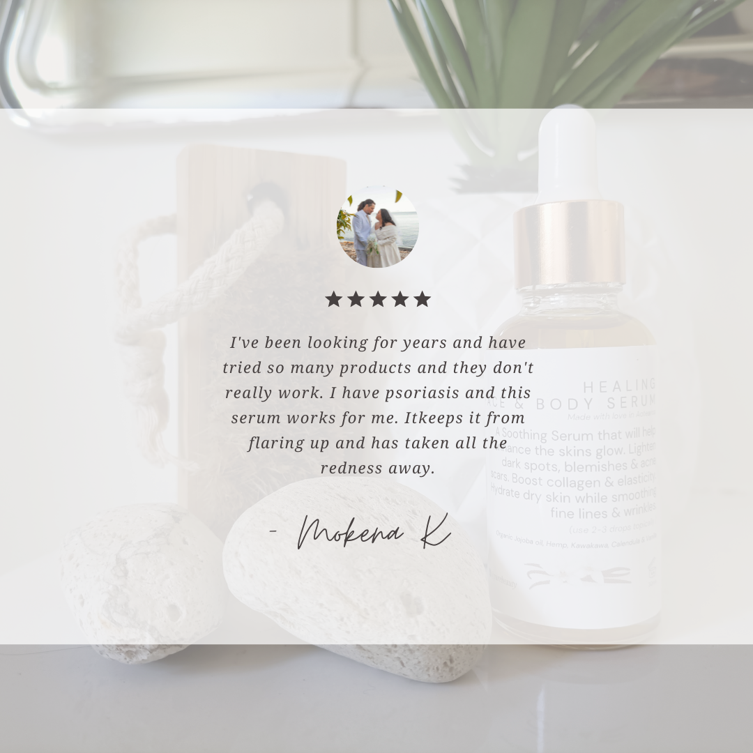 Healing Facial & Body Serum 30ml