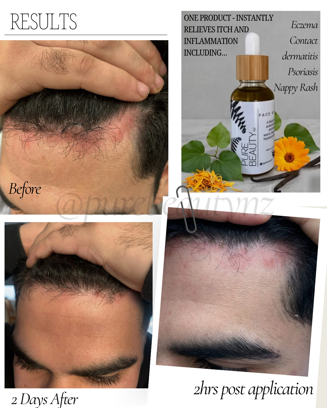 Facial & Body Serum 30ml